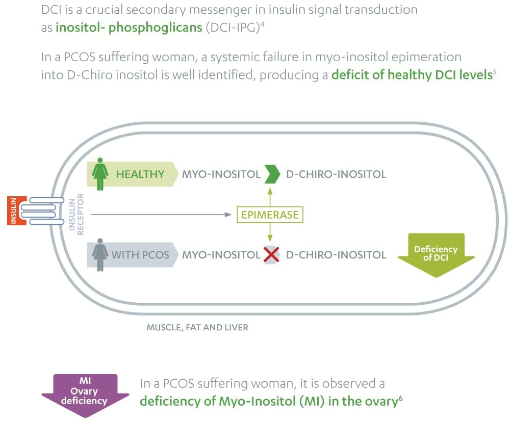 Diagram explaining the deficiency of DCI in PCOS sufferers, with text and labels on a white background.