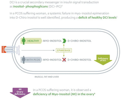 Diagram explaining the deficiency of DCI in PCOS sufferers, with text and labels on a white background.