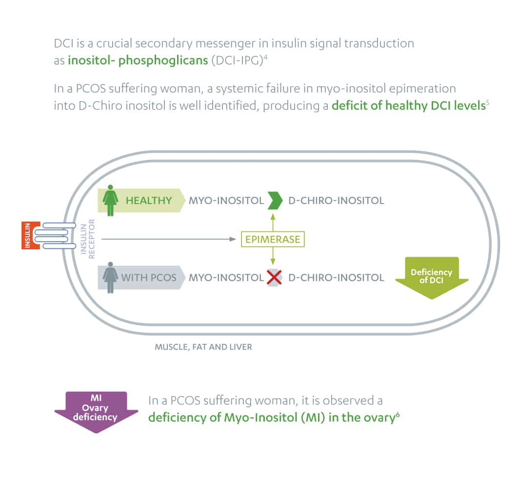 Diagram explaining the relationship between myo-inositol, D-chiro-inositol, and DCI levels in relation to PCOS.